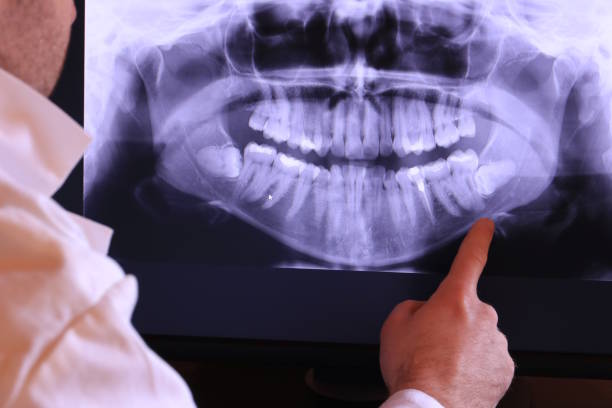 Best Emergency Dental Care for Sports Injuries in Upper Fruitland, NM